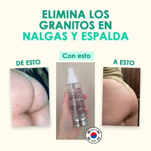 Spray con ácido glicólico para eliminar granitos en glúteos, espalda, entrepierna y pecho